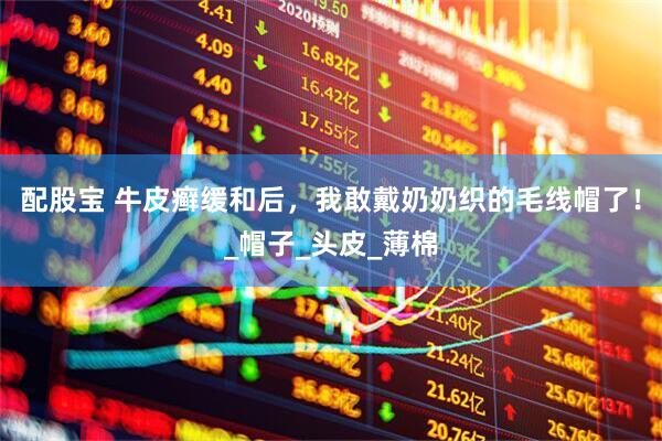 配股宝 牛皮癣缓和后，我敢戴奶奶织的毛线帽了！_帽子_头皮_薄棉